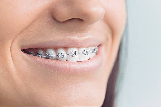 Best General Dentistry  in Monte Sereno, CA
